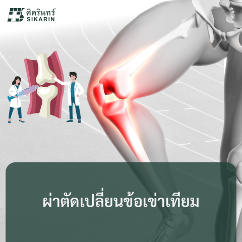 ผ่าตัดเปลี่ยนข้อเข่าเทียม