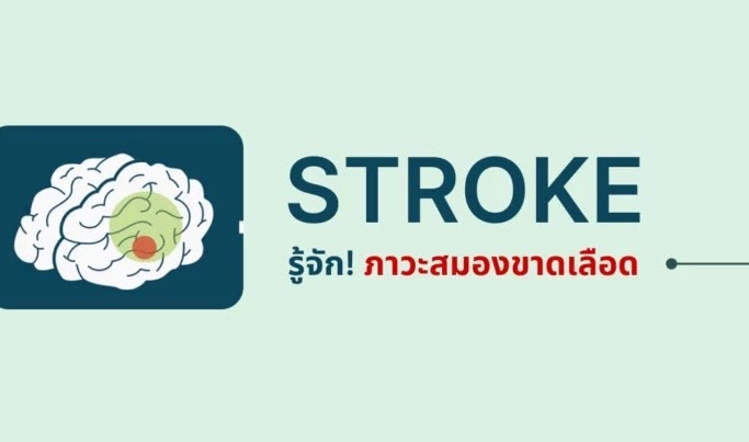 STROKE รู้จัก! ภาวะสมองขาดเลือด