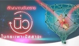 สัญญาณอันตราย “นิ่วในกระเพาะปัสสาวะ”