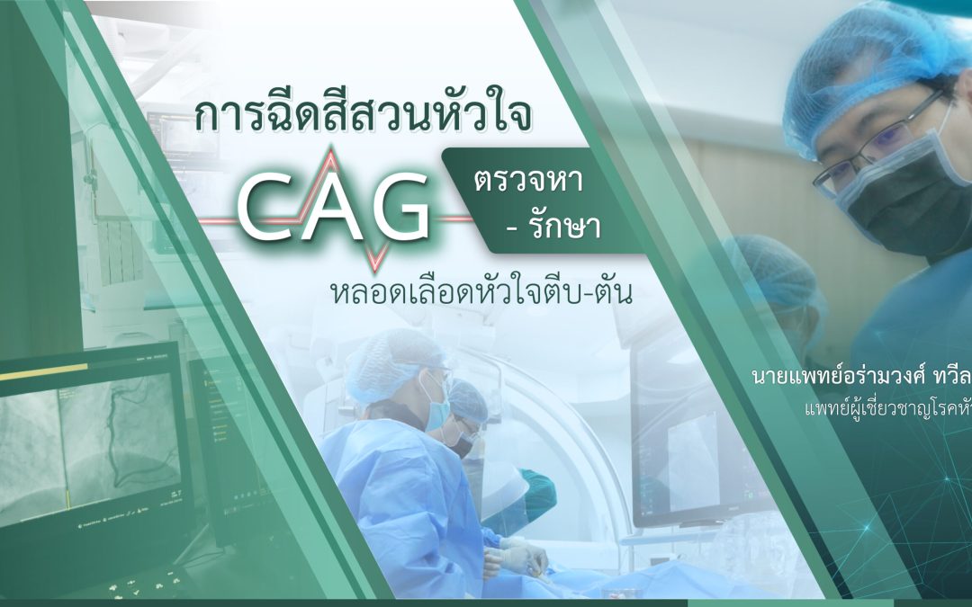 “การฉีดสีสวนหัวใจ” CAG ตรวจหา รักษา หลอดเลือดหัวใจตีบ