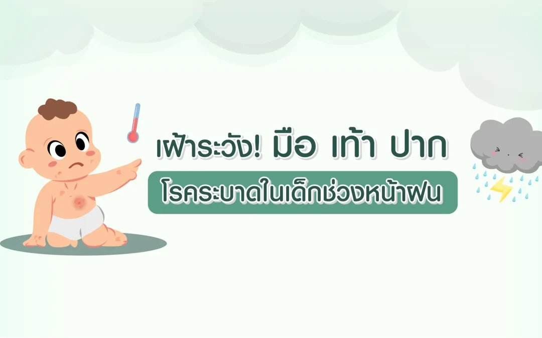โรคมือ เท้า ปาก รับมืออย่างไรดี? สังเกตอาการและวิธีป้องกัน