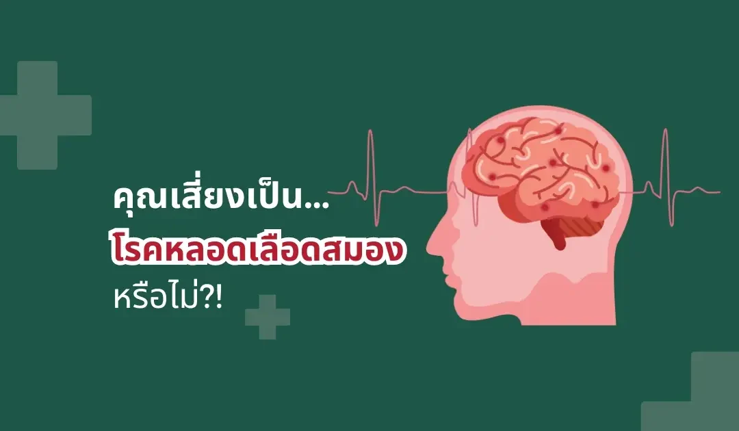 Stroke โรคหลอดเลือดสมอง เสี่ยงทุกวัย