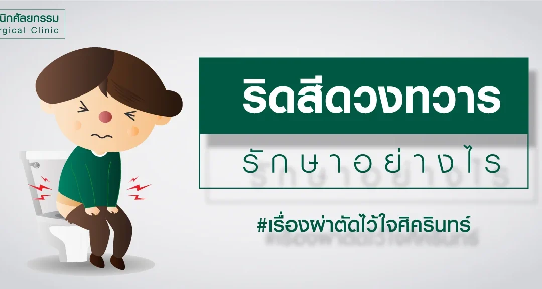 การรักษาโรคริดสีดวงทวาร
