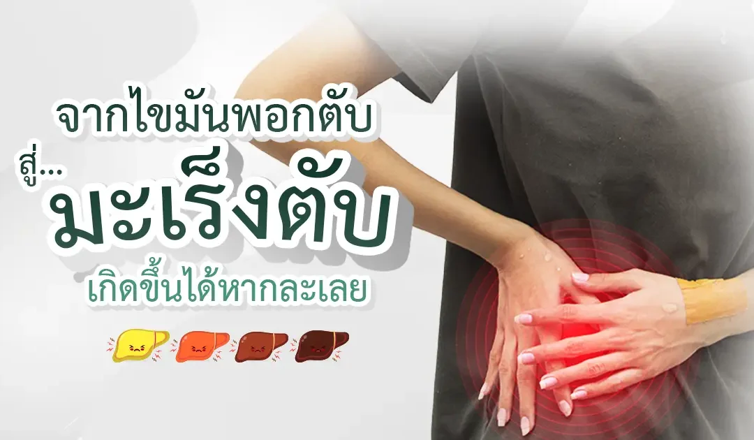 ไขมันพอกตับ… จากเรื่องเล็กใกล้ตัว สู่ “มะเร็งตับ” ที่ไม่ทันตั้งตัว