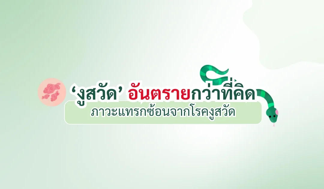งูสวัด อันตรายกว่าที่คิด – ภาวะแทรกซ้อนจากโรคงูสวัด