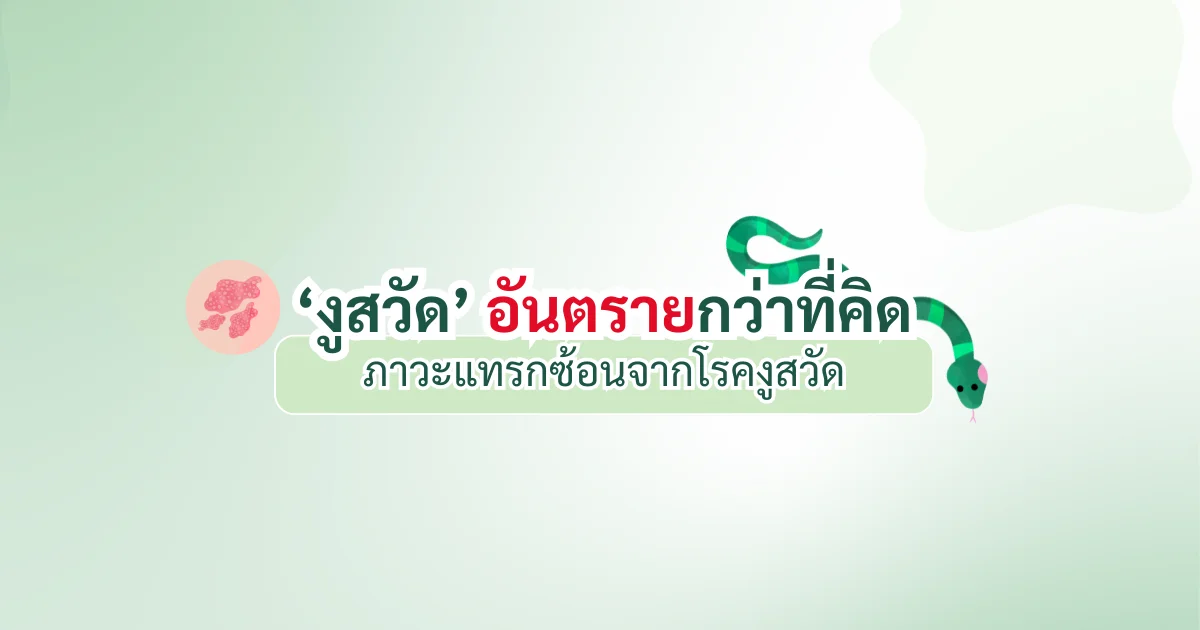 งูสวัด.png